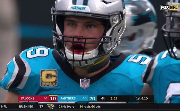 luke-kuechly-bloody.jpg