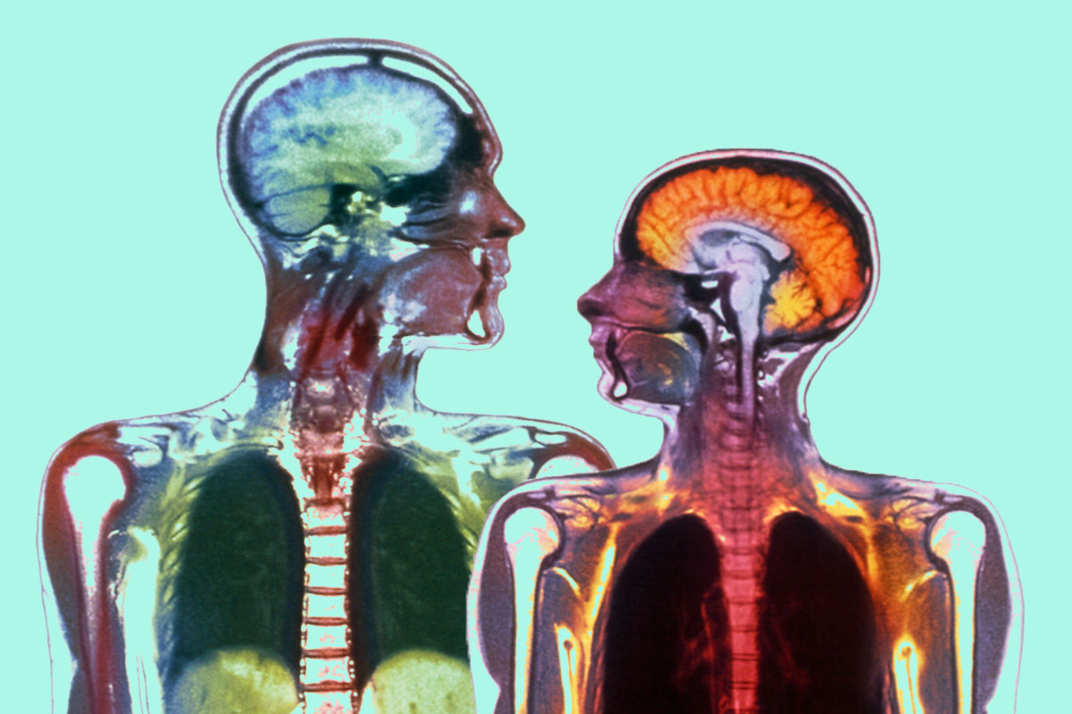 male-female-brain-aging.w536.h357.2x.jpg